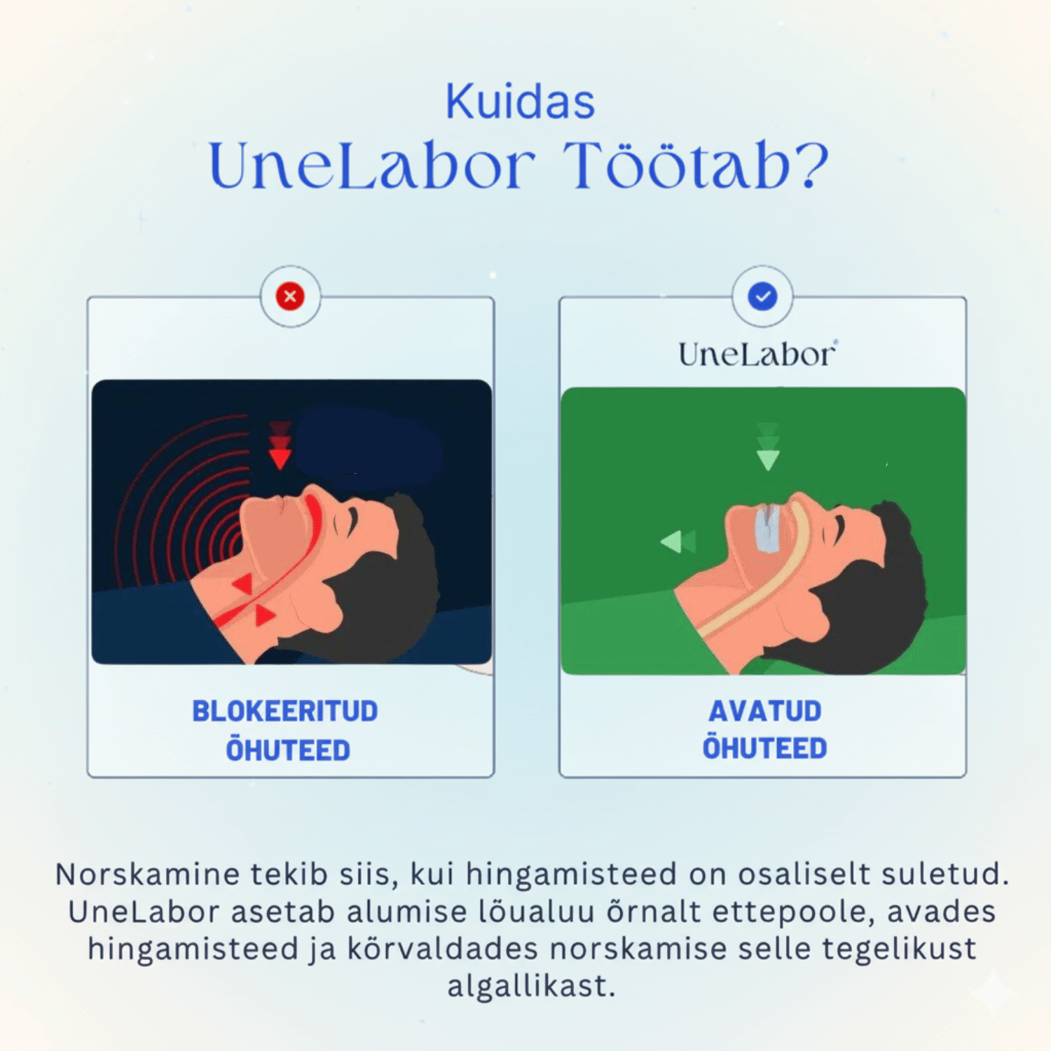Unelabor Norskamisvastane Hambakaitse